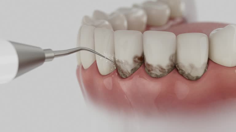 Trusted Invisalign Clear Aligners service in Bells, TX - Dentist Open Now